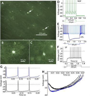 Broadband Entrainment of Striatal Low-Threshold Spike Interneurons